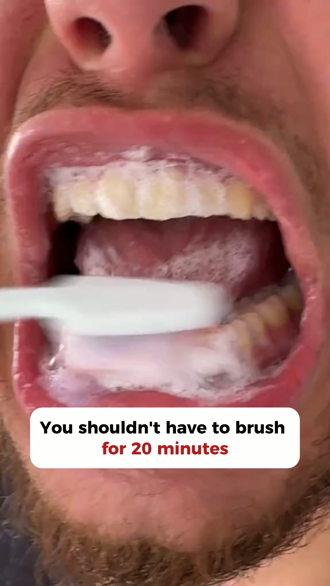 Yellow Buildup Starts Where Regular Brushes Miss