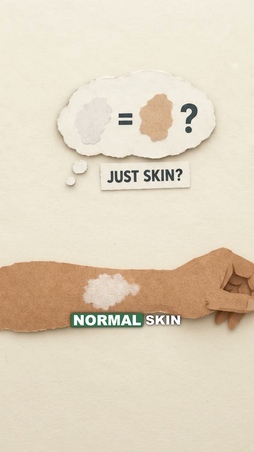 Fast and easy fix for vitiligo.