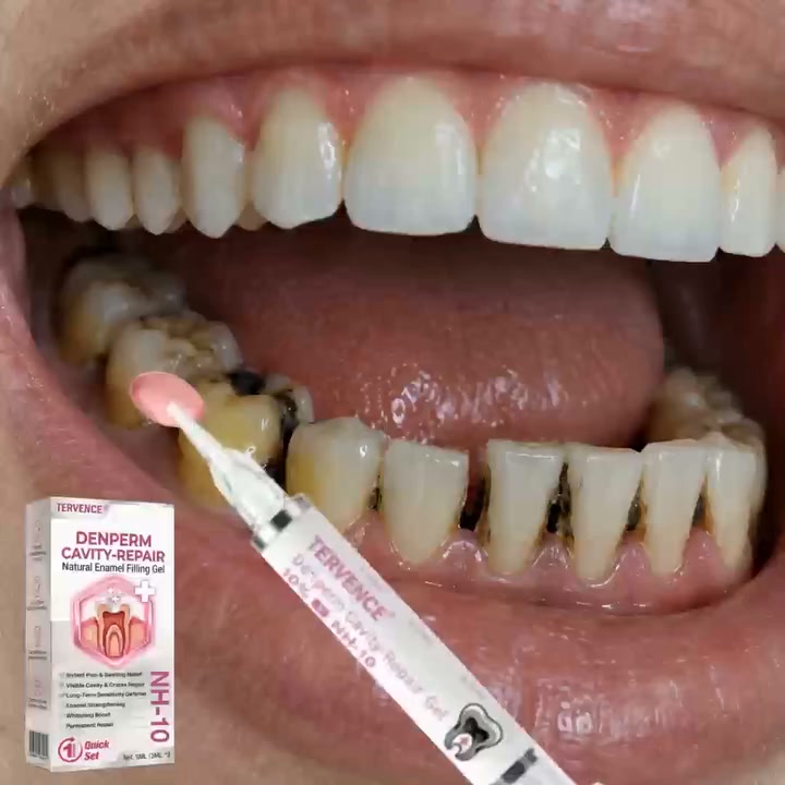 Repair Natural Enamel Filling Gel