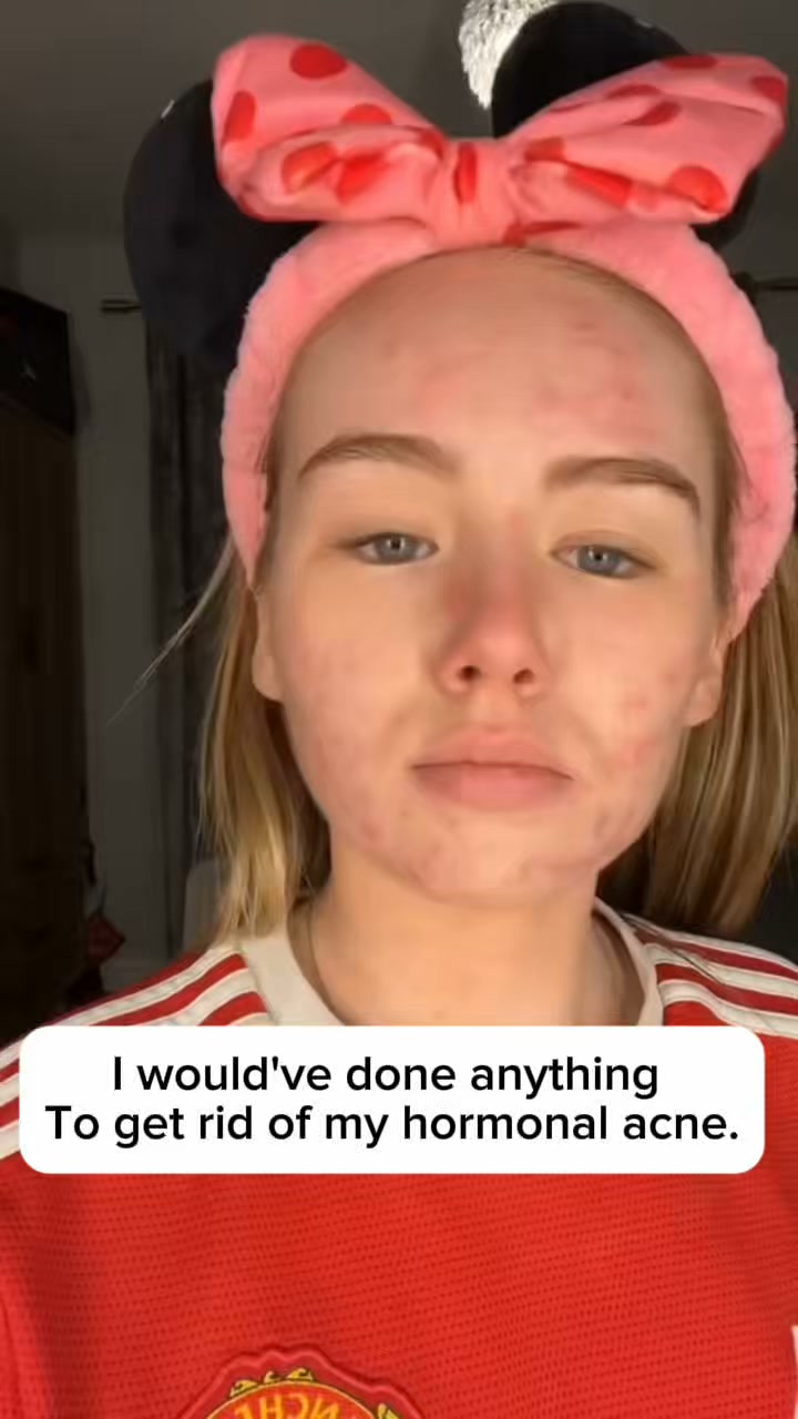 Your skin routine might be missing this.