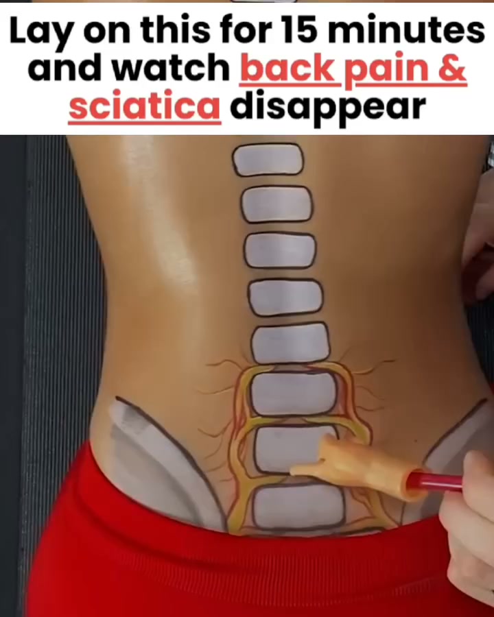 Relief Is Here for Sciatic Back Pain