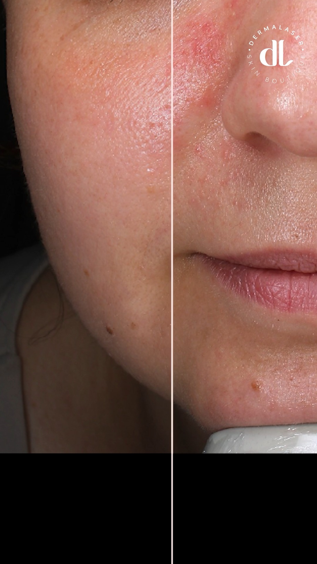 Anúncio de Dermalaser Skin Boutique