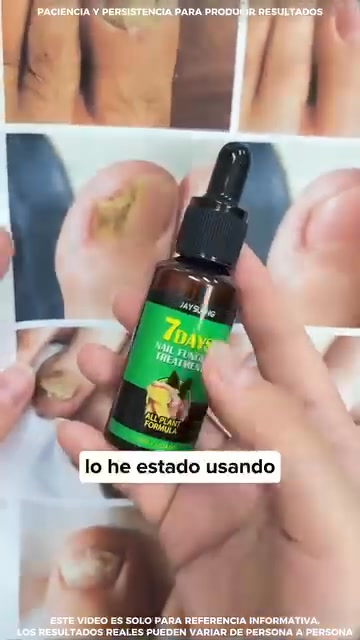 Uñas Más Fuertes y Saludables Desde Casa