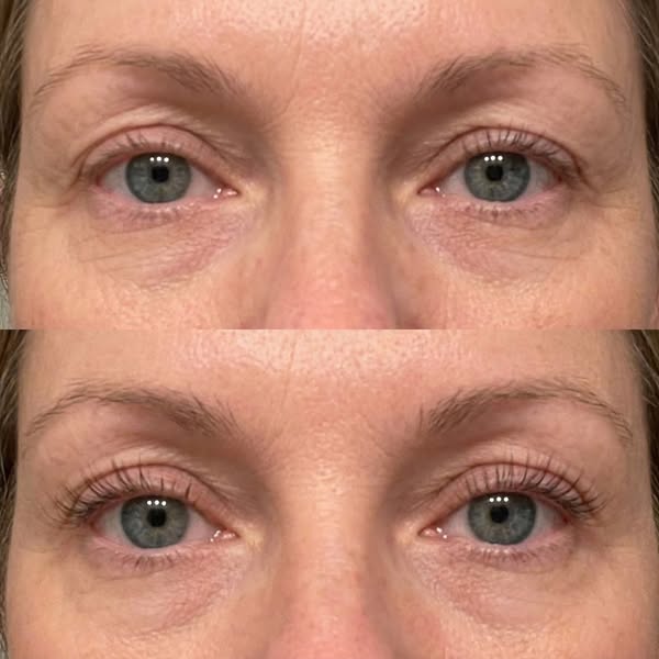 Your Lashes Back, Without the Risk