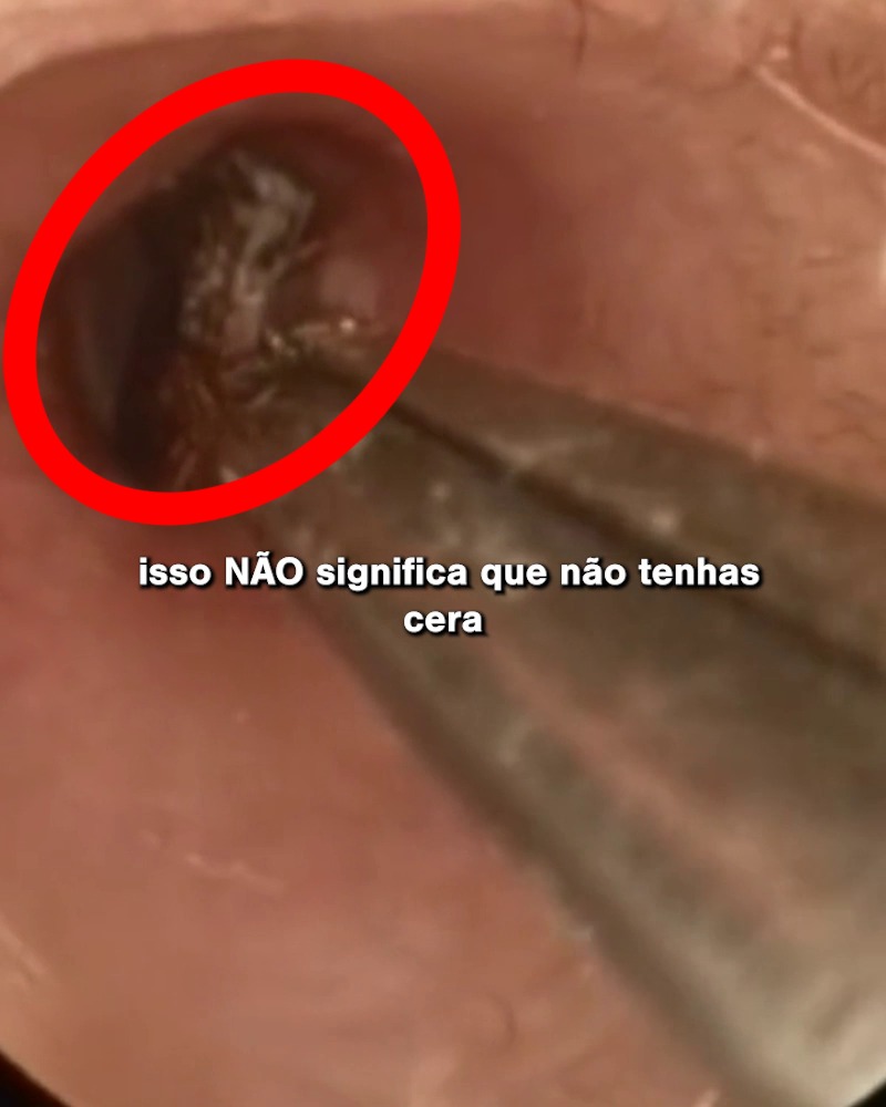 Cobrança Disponível
