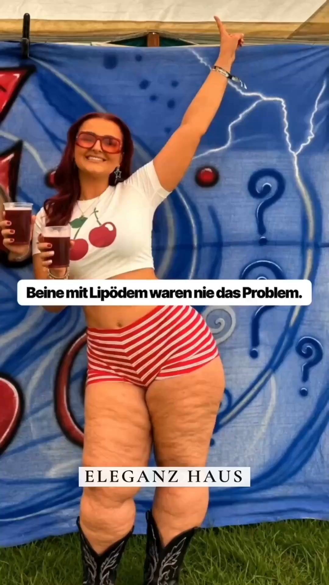 Normale Leggings bedecken. LESIRA formt.