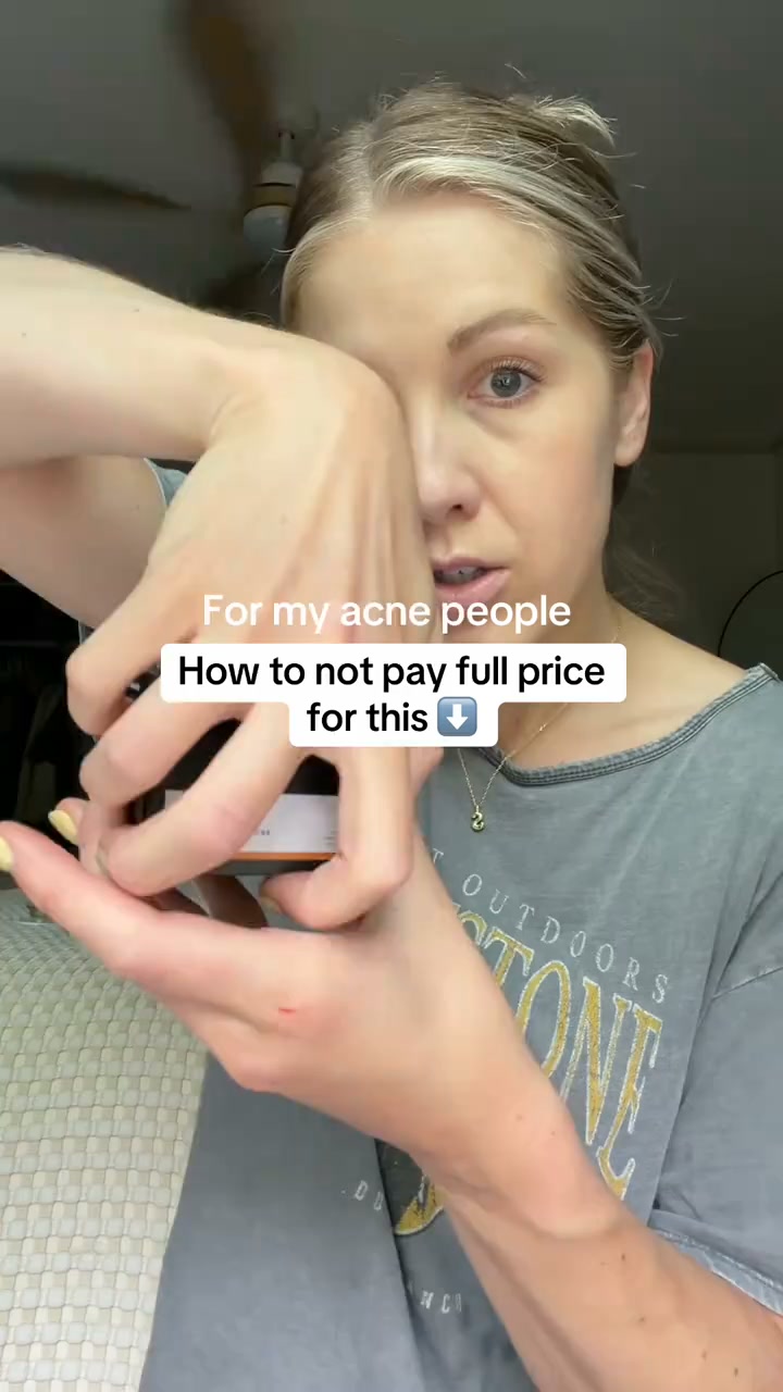 Fix Acne NOW!