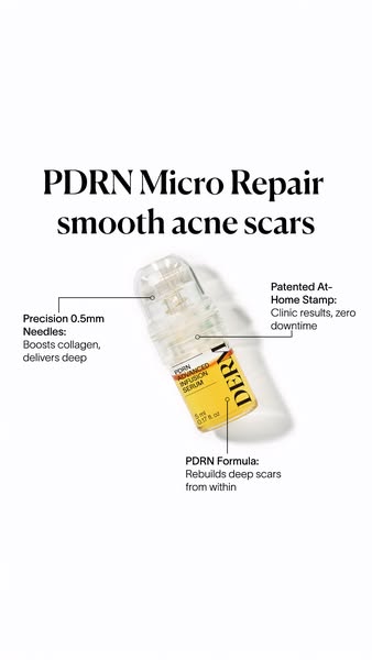 Fade Post-Acne Scars at Home