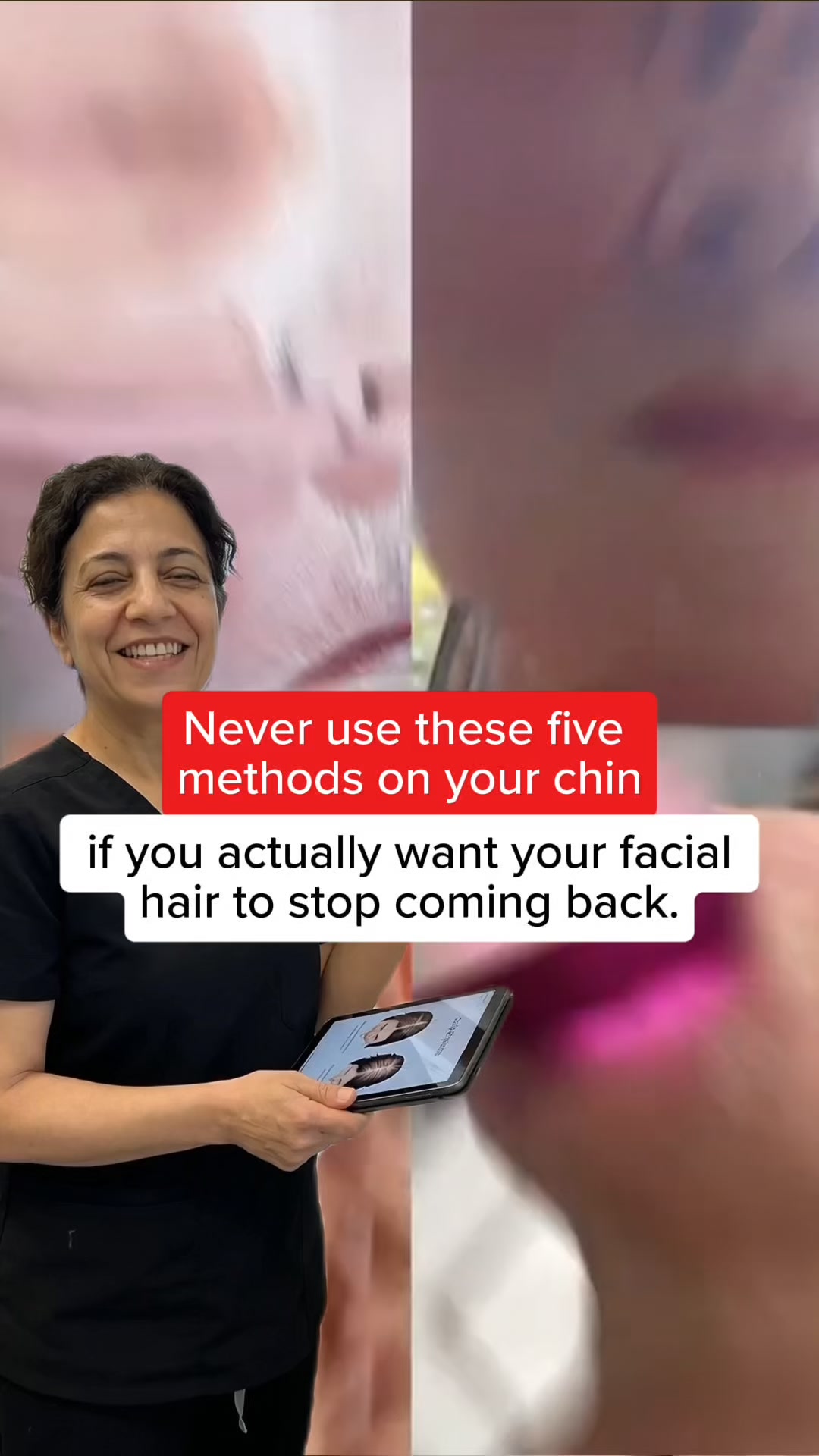 Stop your chin hair from growing back.