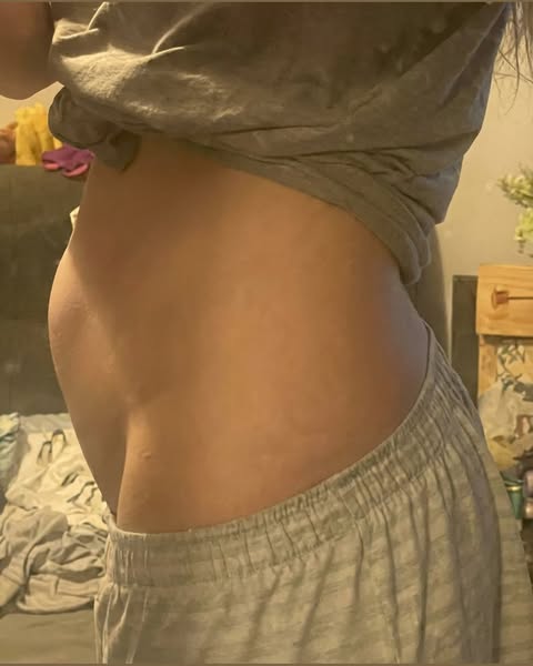 ¿Tu barriga? No es grasa.