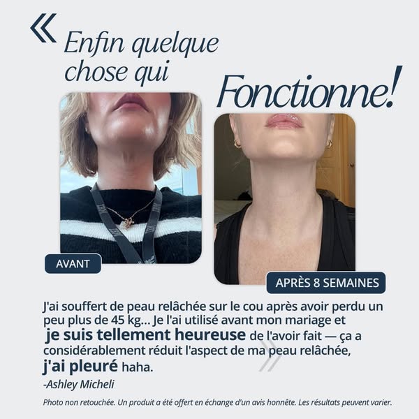 Peau du cou relâchée ? Essayez ceci
