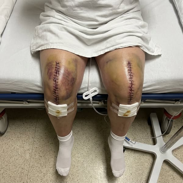 "12 years of knee pain gone in 2 days?"