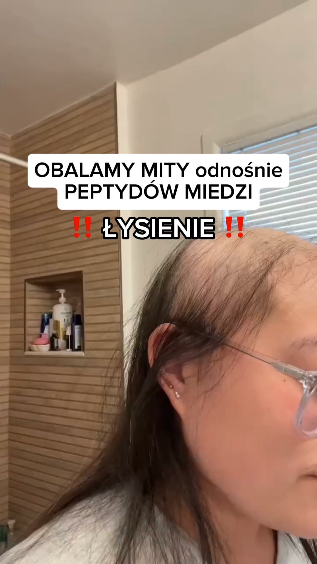 Zatrzymaj Wypadanie. Przywróć Porost.
