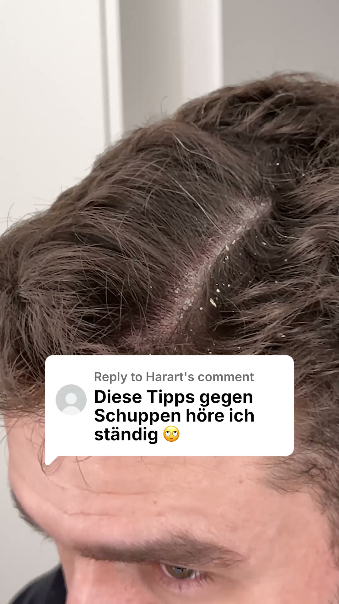 Juckende Kopfhaut nervt? Mach Schluss damit.