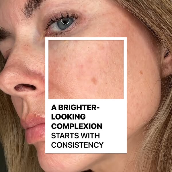 Get Healthy-Looking Skin