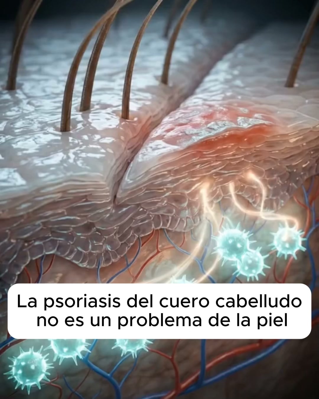 El bálsamo natural que frena el picor de raíz.