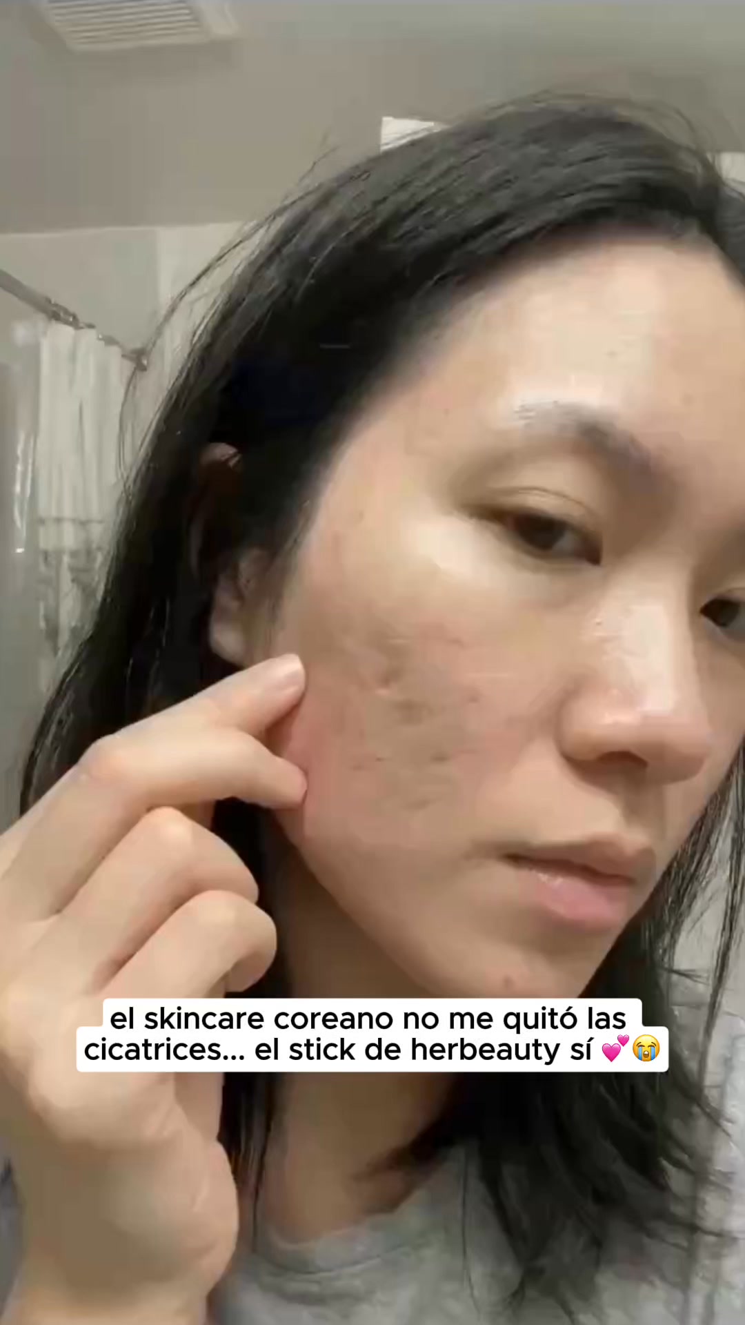 Si Tienes Marcas Mira Esto