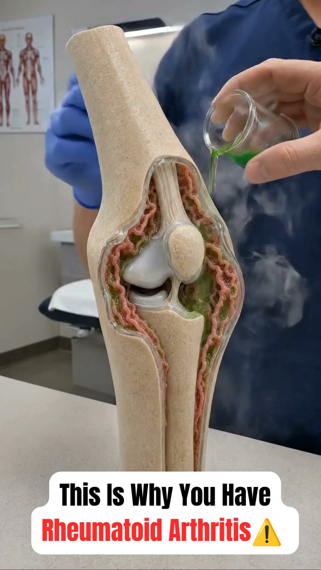 The truth about rheumatoid arthritis