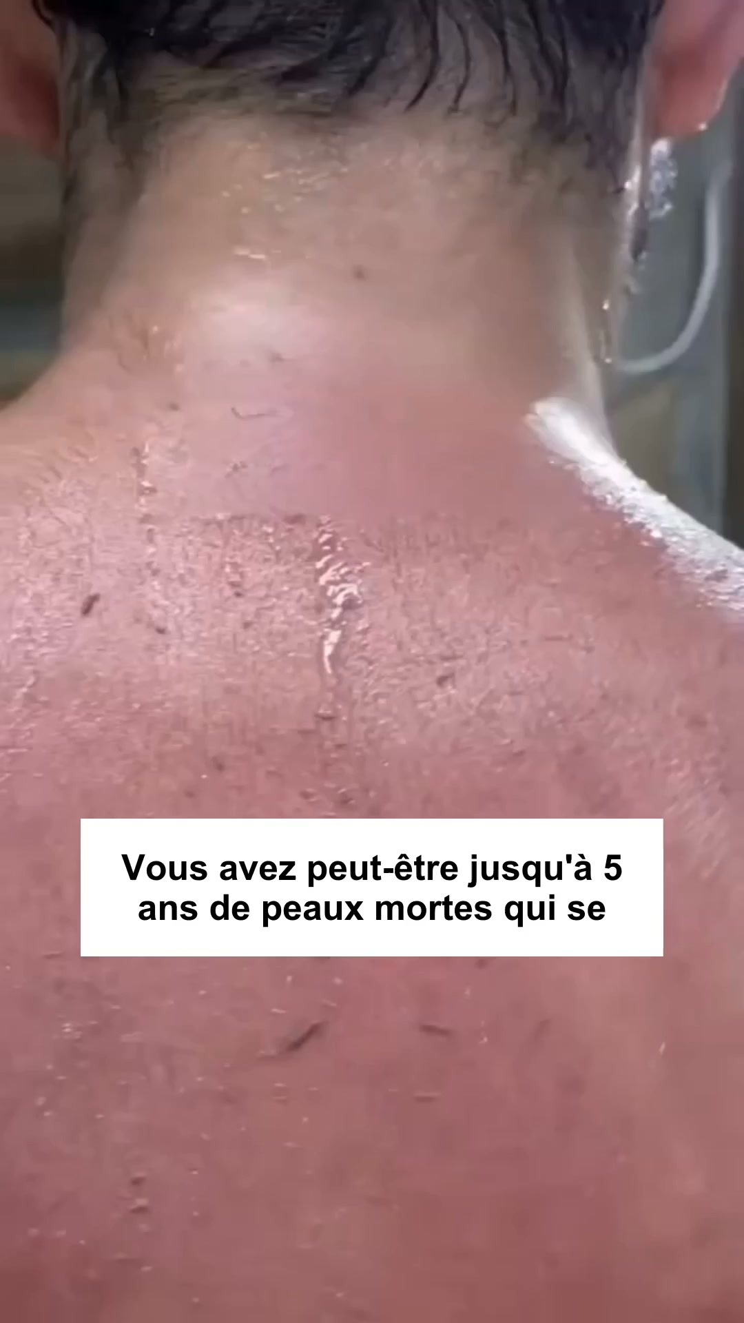 Une peau renouvelée