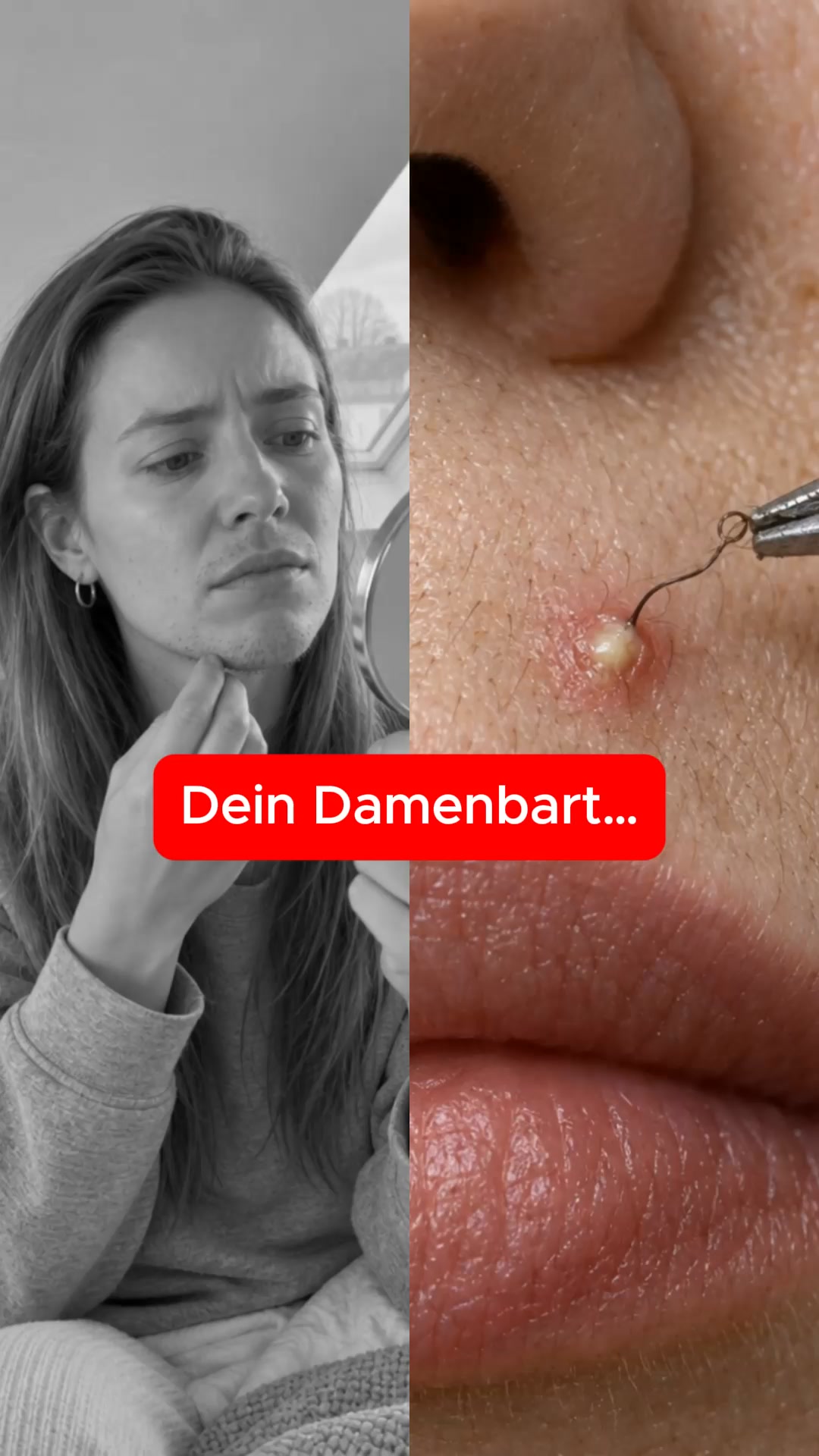 Damenbart? Hör auf zu rasieren, zupfen oder Lasern!