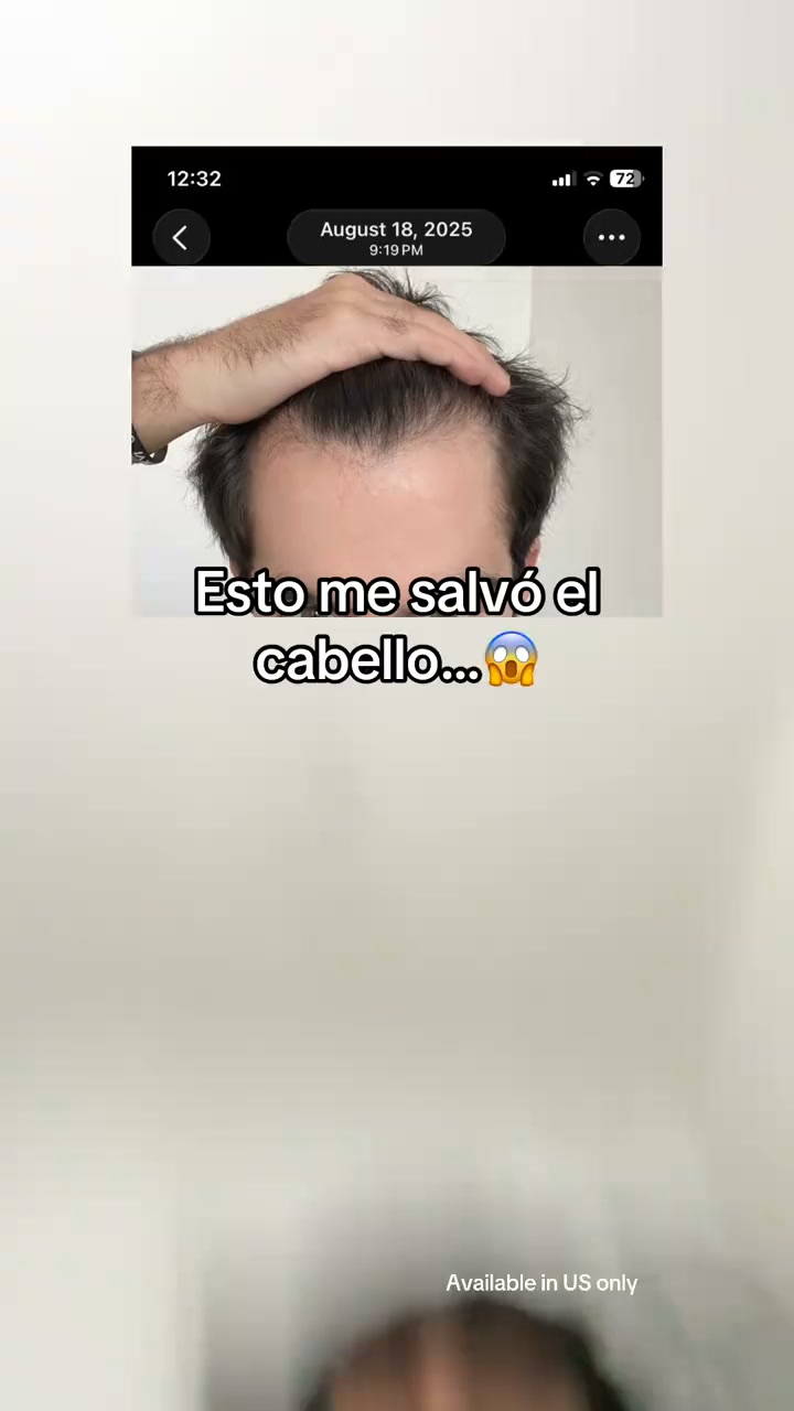 Deja de quedarte calvo