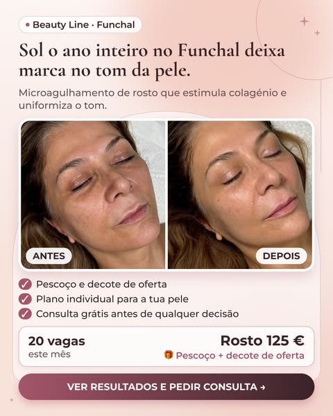 Vê os resultados reais no site