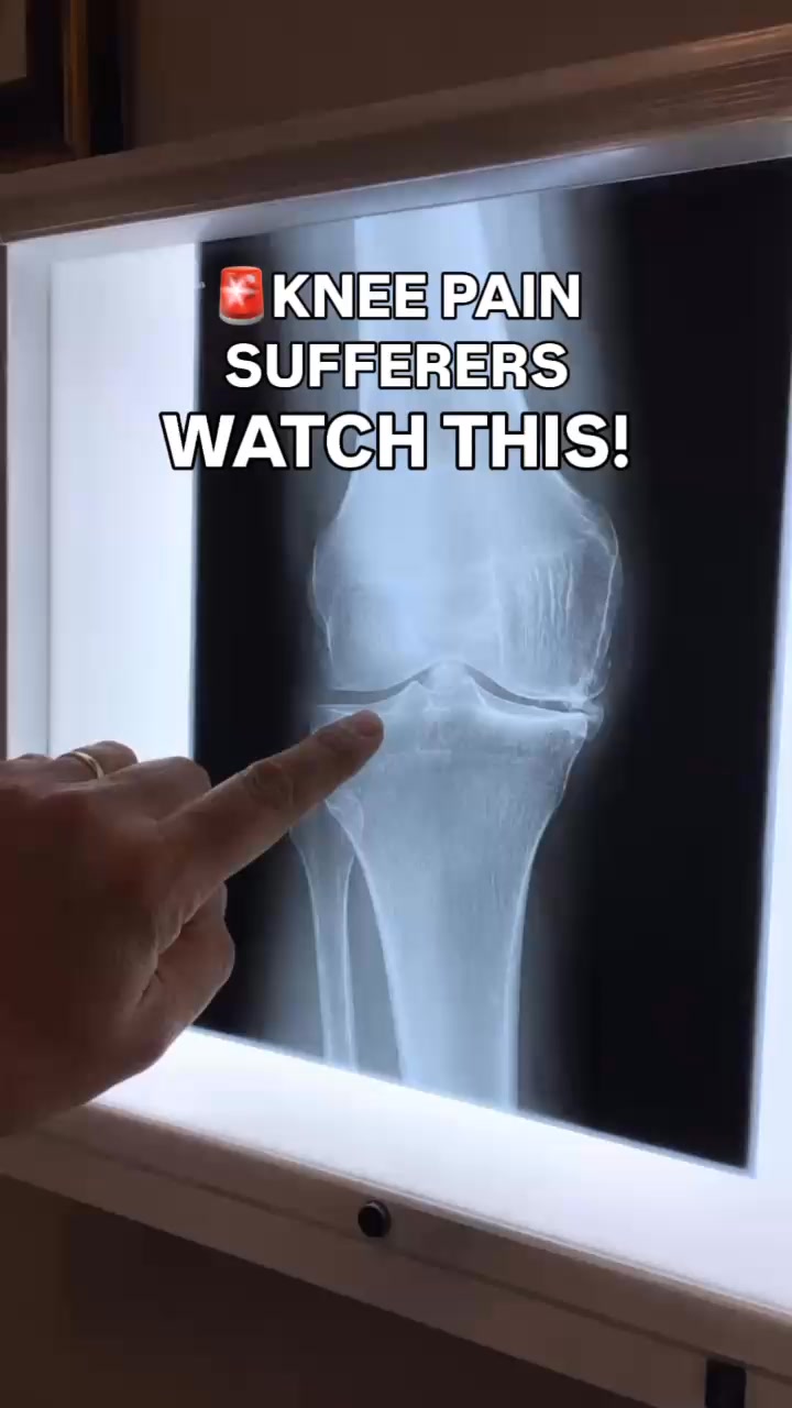 #1 Recommended Knee Pain Relief Patches For Arthritis
