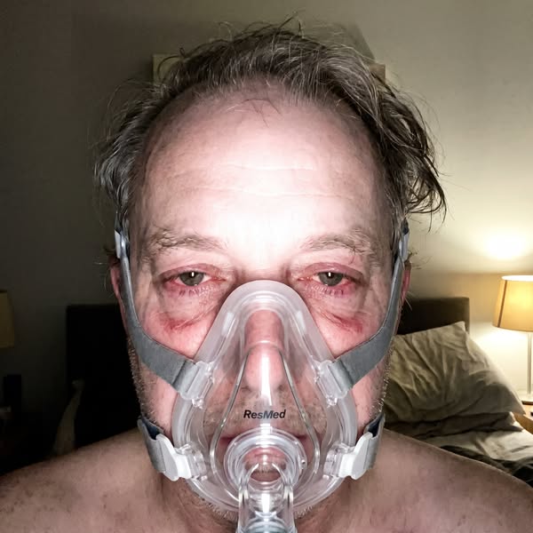 My Husband's Snoring Is Ruining My Life And Nobody Will Help Us.