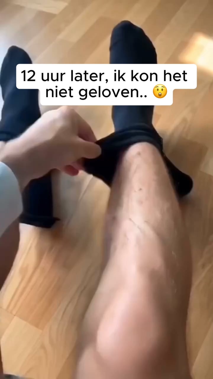 Nooit meer worstelen met gewone compressiekousen!