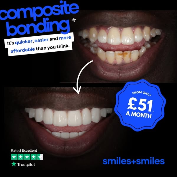 Book In Now For Your Summer Smile