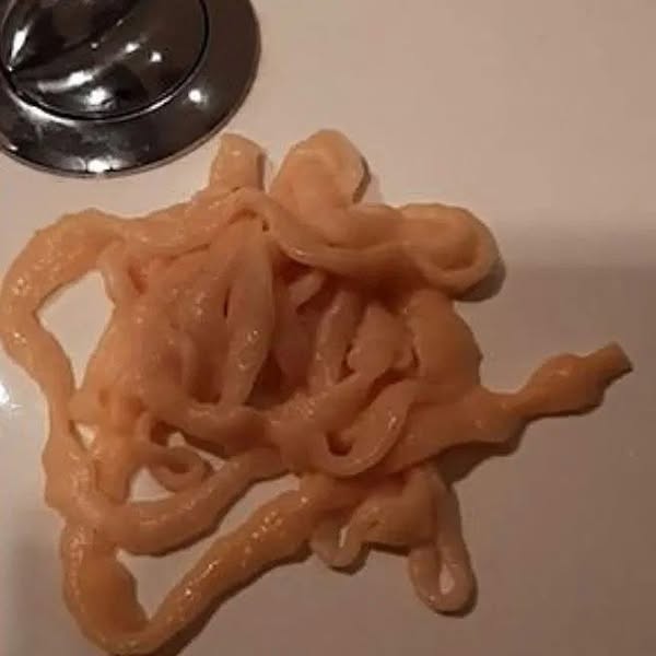 Why Every Parasite Cleanse Weld Tried Failed