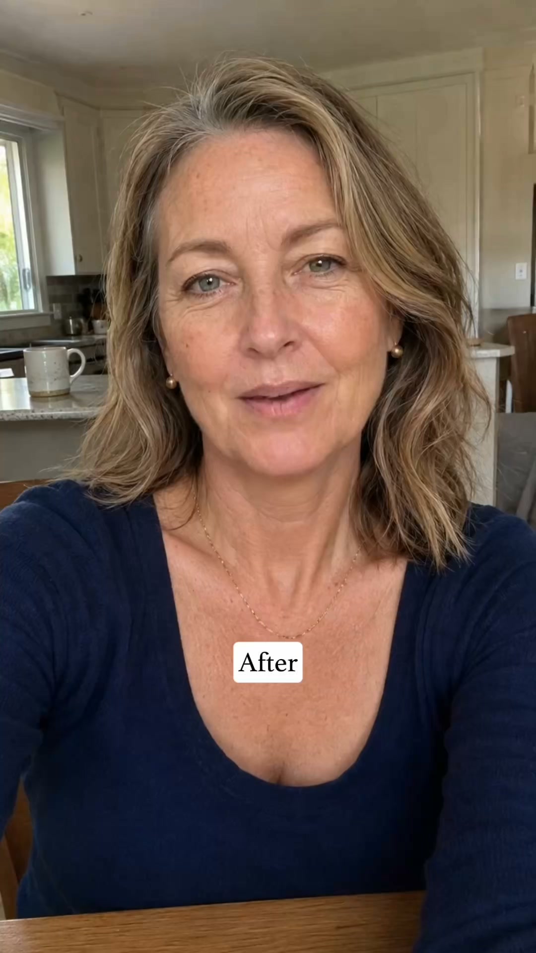 How I fixed my saggy neck without surgery...