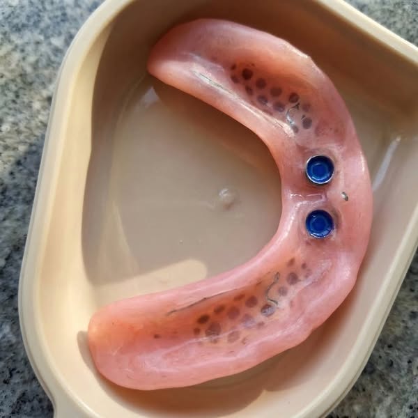 Read this if you wear dentures