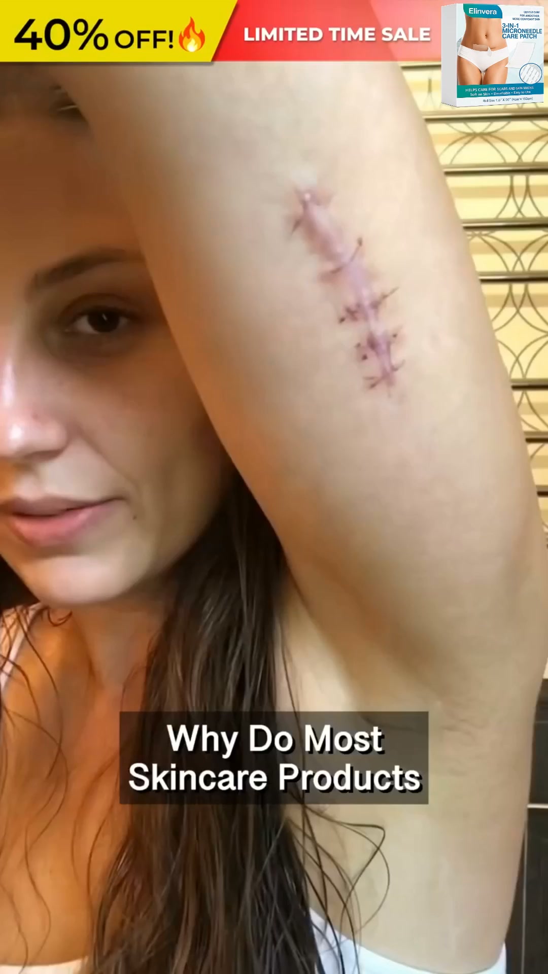 Help Your Scars Look Smoother—One Patch at a Time