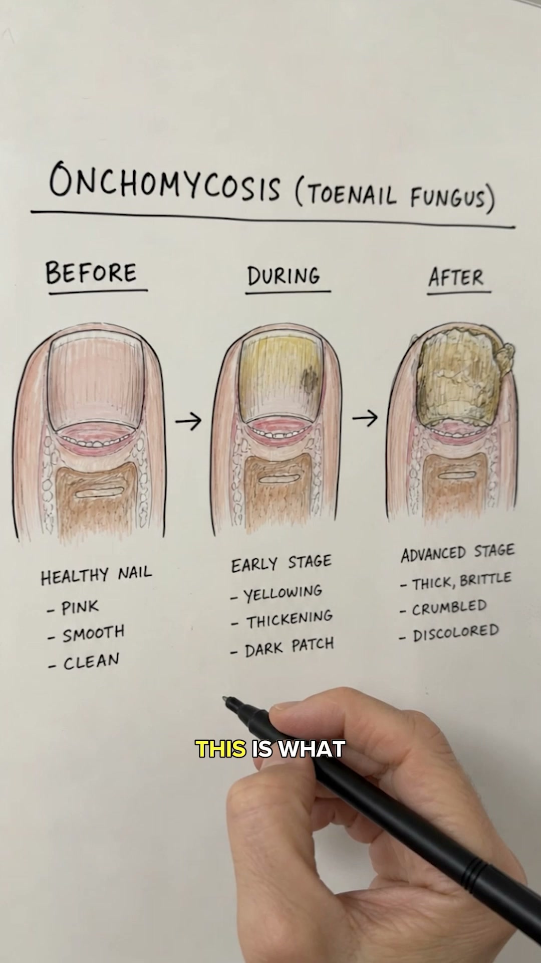 See Improvement... or It's Free!