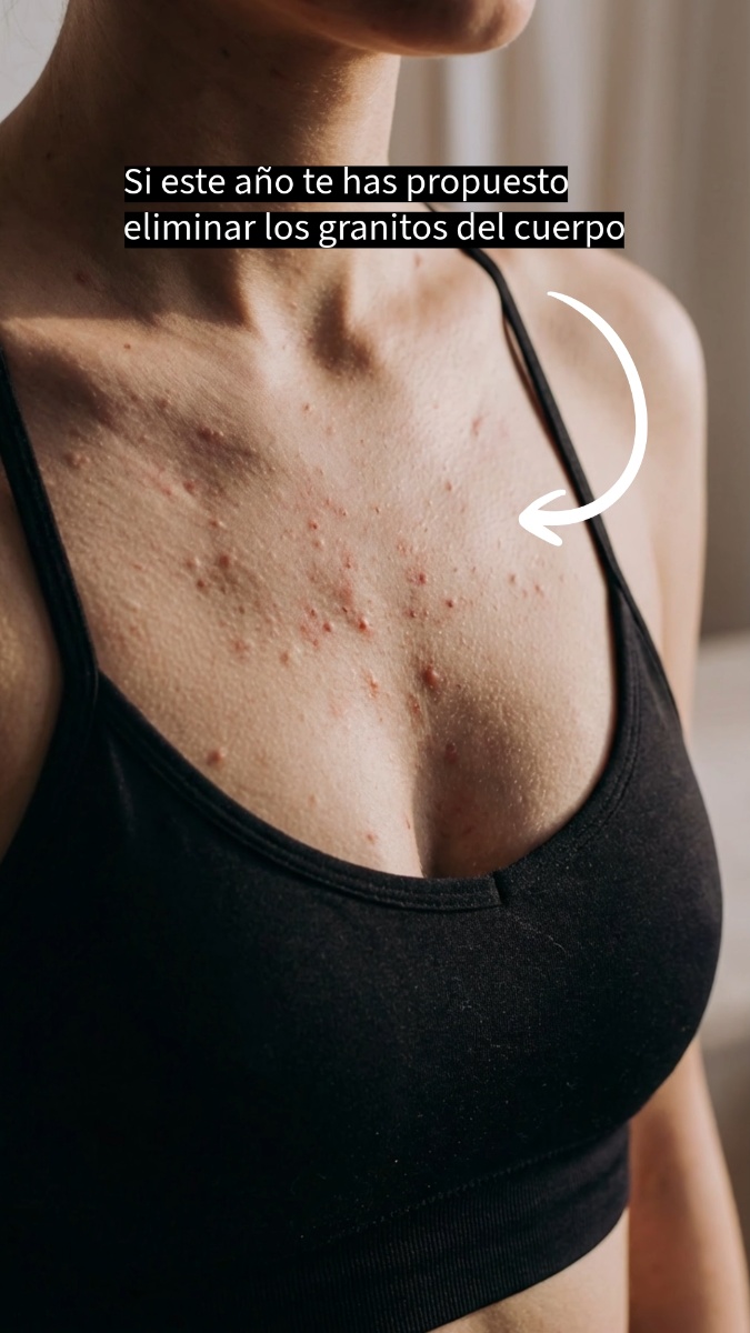 Consigue una piel clara y suave en los glúteos