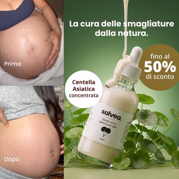 Siero anti smagliature