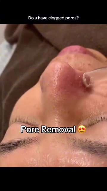 Tired of looking in the mirror and seeing clogged pores... again?