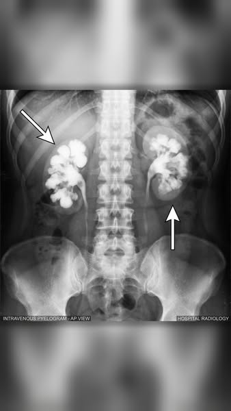 Everyone with joint issues needs to see this