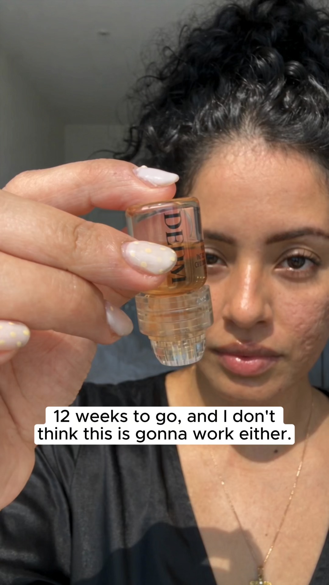 My 12-Week Acne Scar Countdown
