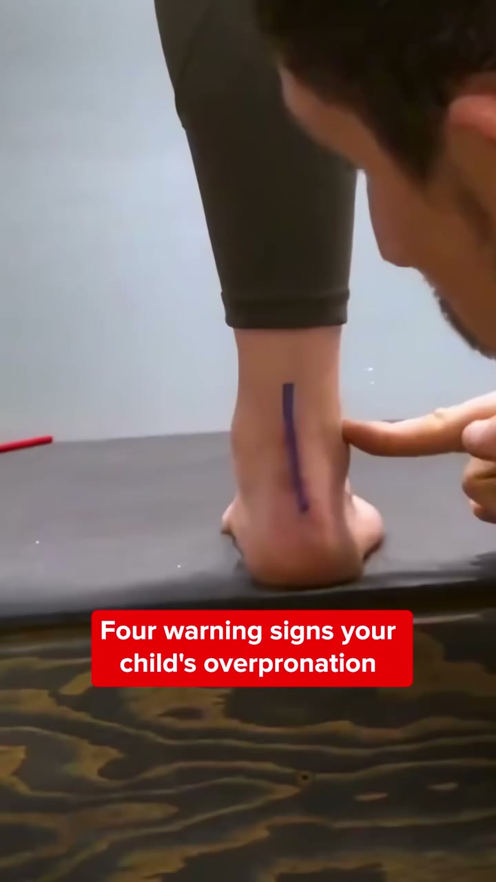 Support Flat Feet the Right Way