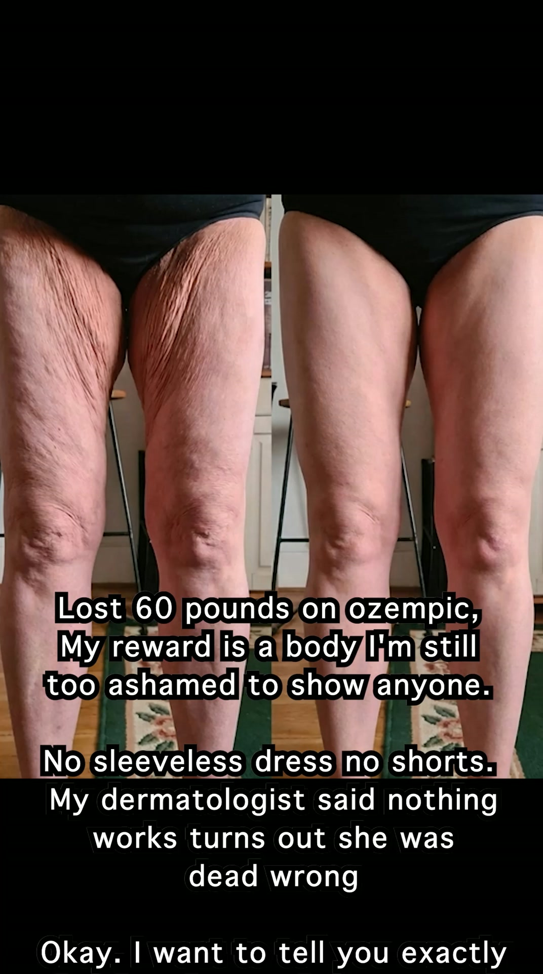 Say Goodbye to Creepy Skin