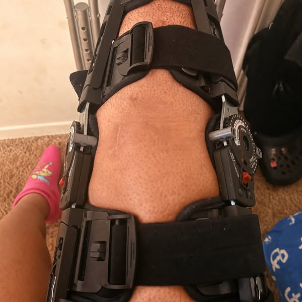 Knee Pain? Read this