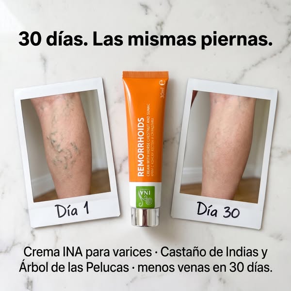 30 días. Las mismas piernas. Otro espejo.