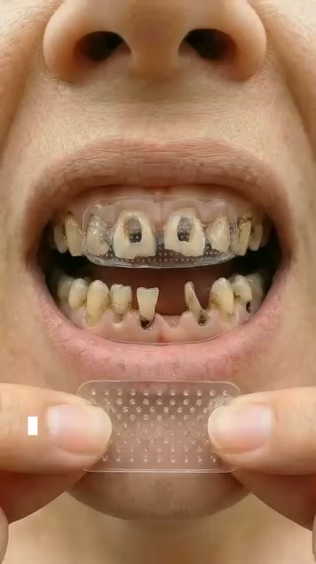 The Future Of At-Home Tooth Care Is Here