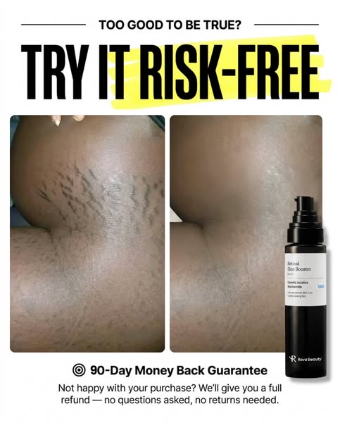 Buy 1, Get 1 FREE