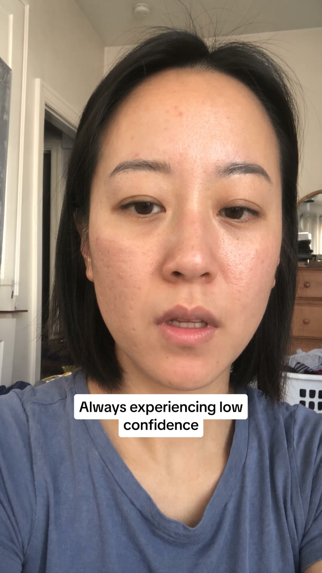 PDRN Heals Acne Scars