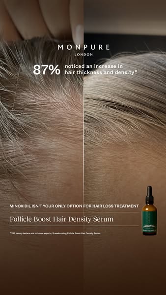 Discover A Natural Alternative To Minoxidil