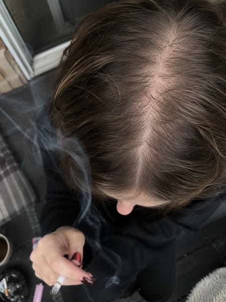 Read This If Your Hair Is Thinning