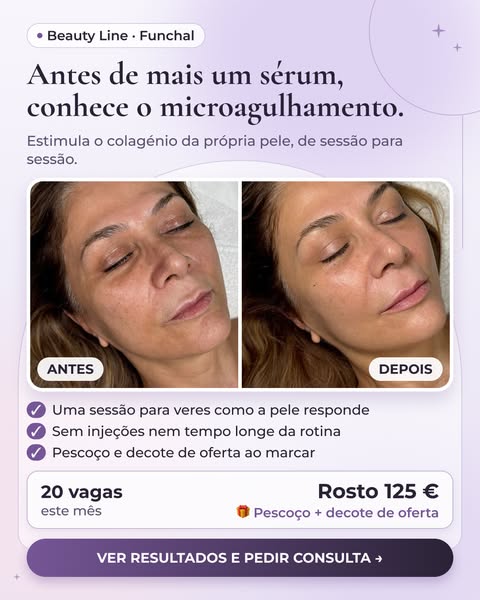 Vê os resultados reais no site